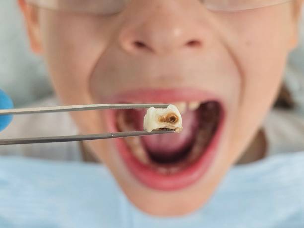 Best Emergency Pediatric Dental Care in Premont, TX